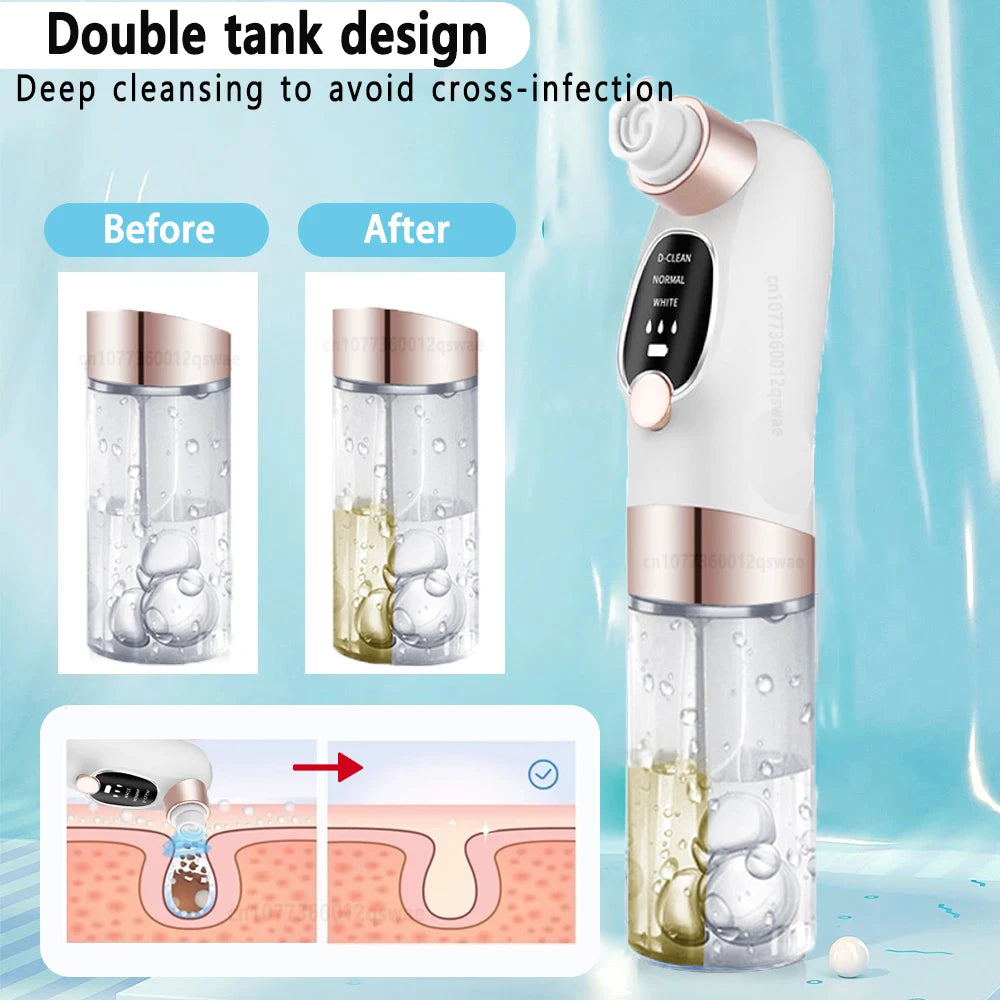 Aspirateur à points noirs Luméra Skin
