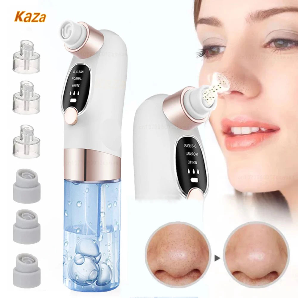 Luméra Skin Blackhead Remover