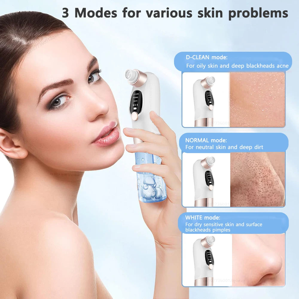Aspirateur à points noirs Luméra Skin