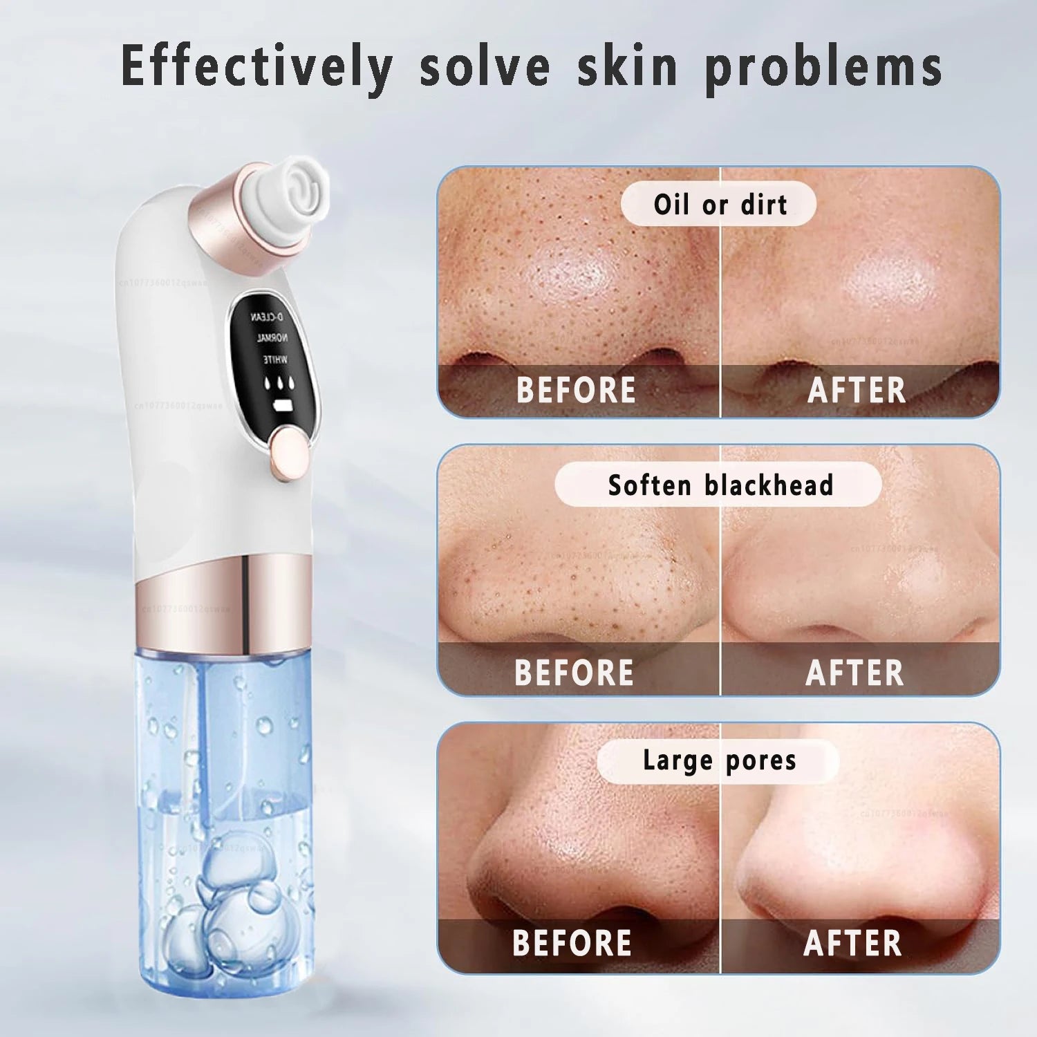 Aspirateur à points noirs Luméra Skin