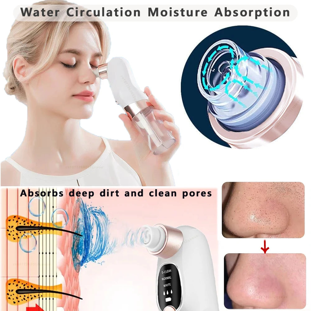Aspirateur à points noirs Luméra Skin